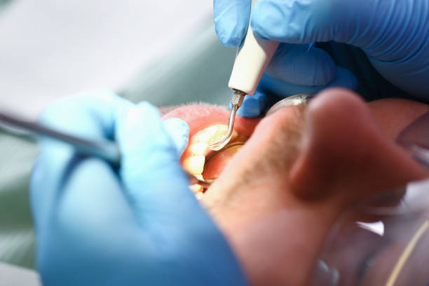 Best Emergency Gum Treatment in Wellsville, KS