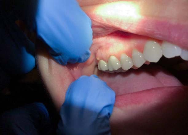 Best Same-Day Emergency Dental Services in Wellsville, KS