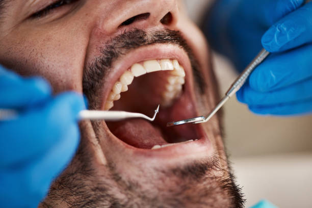 Best Emergency TMJ Treatment in Wellsville, KS
