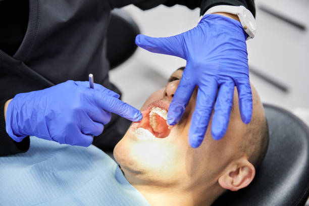 Best Emergency Root Canal Treatment in Wellsville, KS