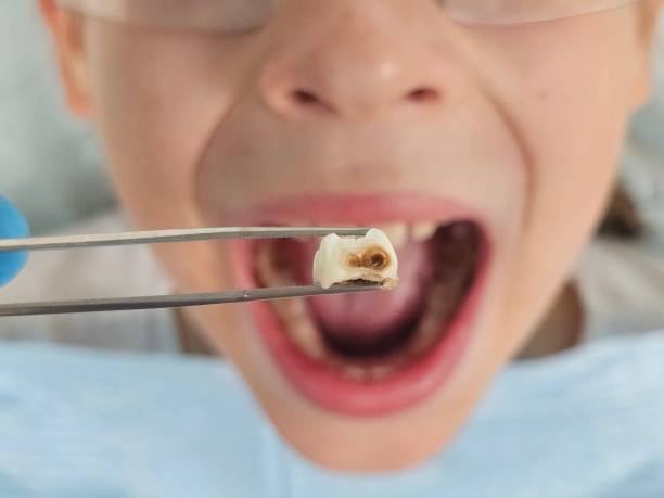Best Pediatric Emergency Dentist in Wellsville, KS
